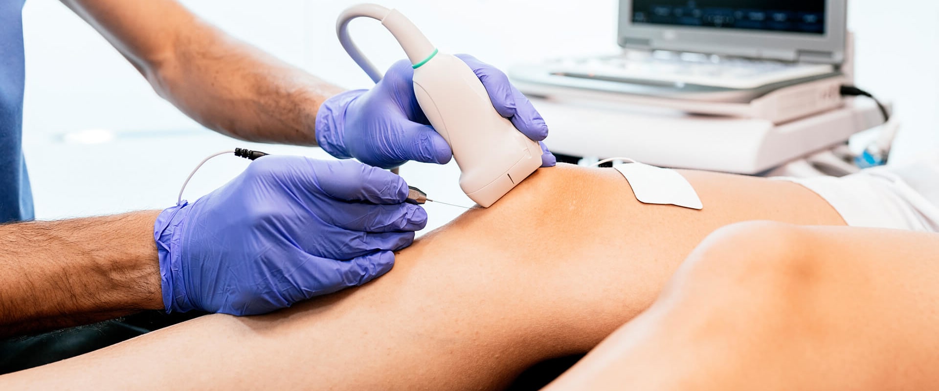 IV Regenerative Therapy With Natural Remedies: How It Works In Charlotte, NC
