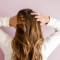 Combining Follicular Unit Transplantation With Natural Remedies In The Bay Area