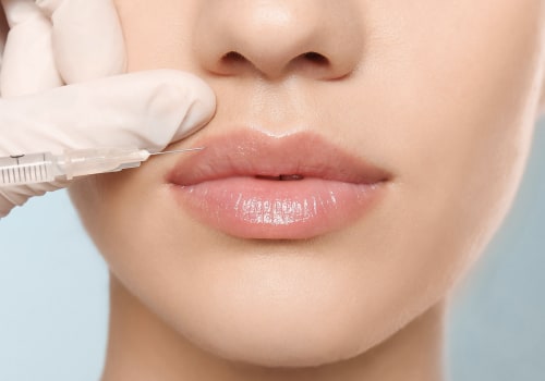 Lip Augmentation in Zürich: How Natural Remedies and Professional Care Work Together
